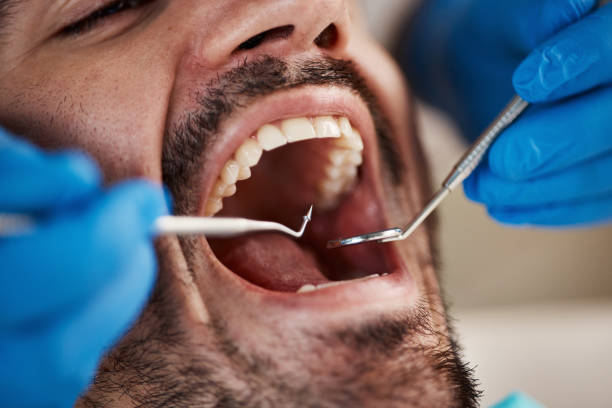 Best Emergency Denture Repair in Sand Springs, OK
