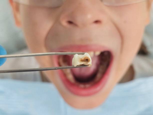 Best Emergency Gum Treatment in Sand Springs, OK
